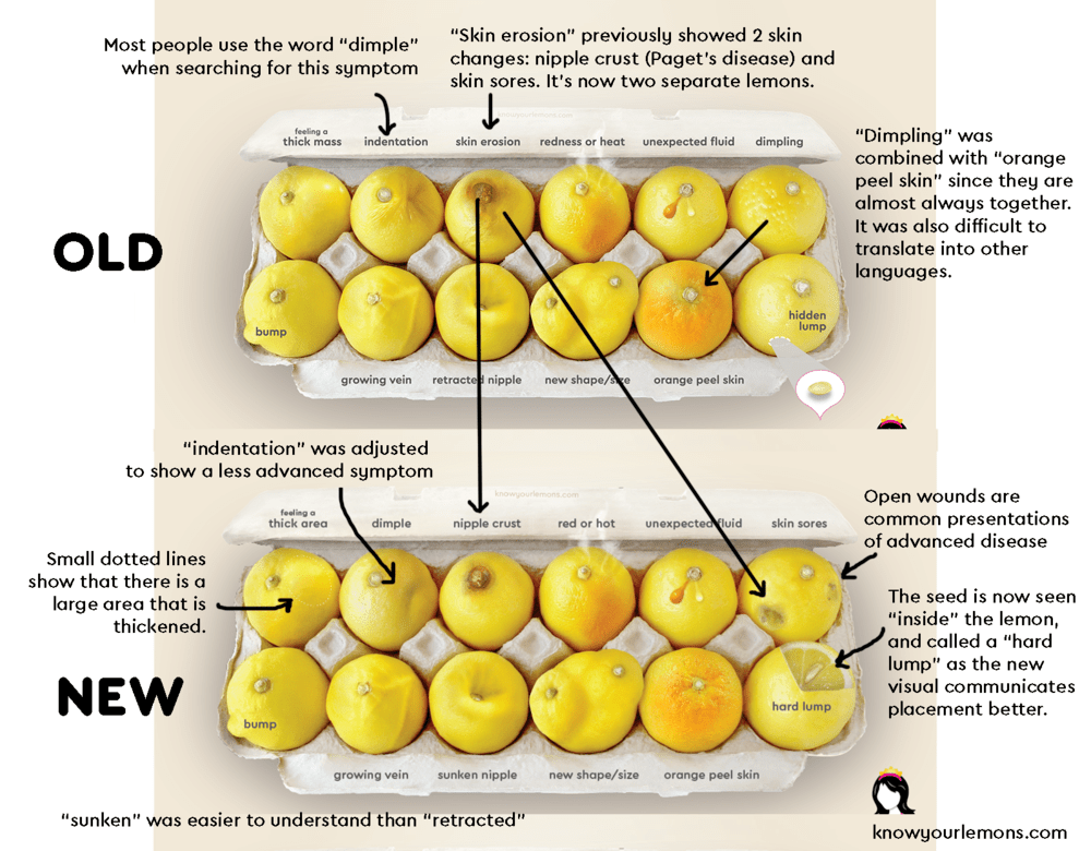 Breast Cancer Self Look and Feel